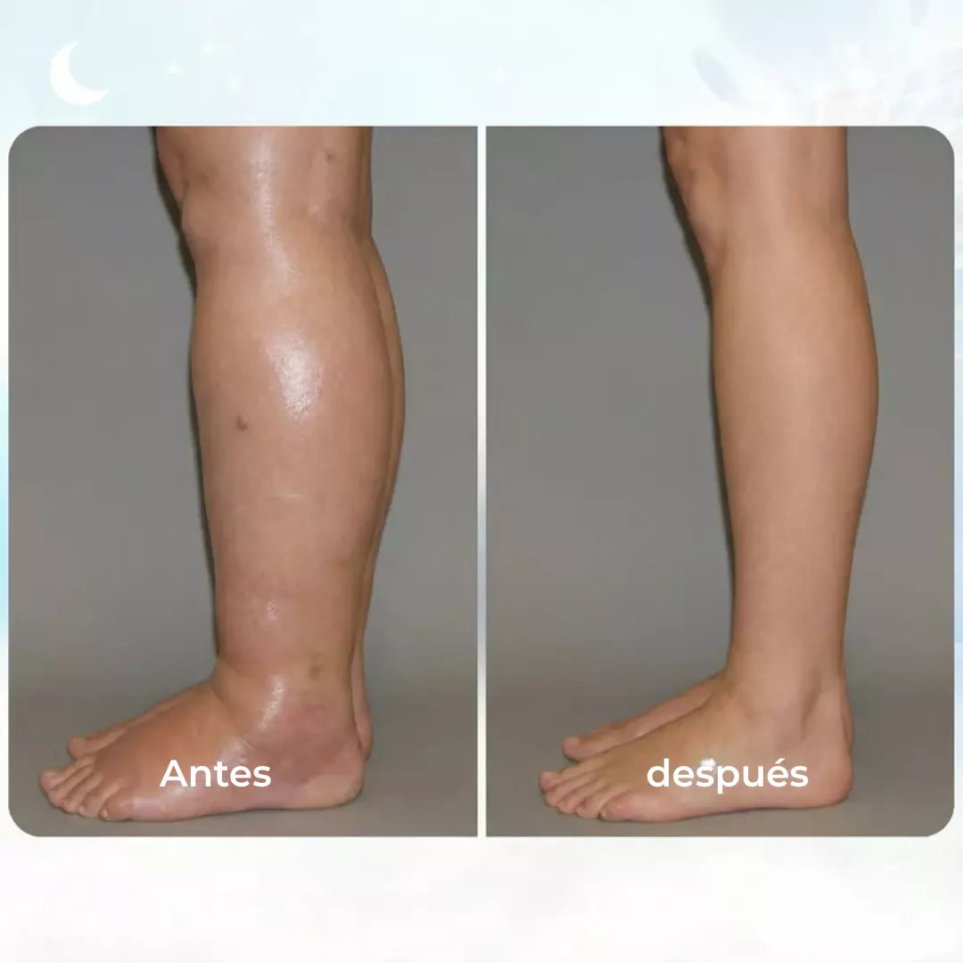 ORNEXIS – EMS PARA ALIVIAR LAS PIERNAS HINCHADAS DESDE CASA